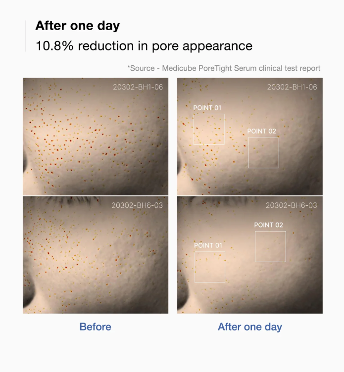 MEDICUBE Zero Pore One-day Serum