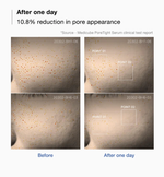 Load image into Gallery viewer, MEDICUBE Zero Pore One-day Serum
