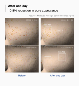 MEDICUBE Zero Pore One-day Serum